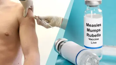 Current Measles Outbreaks: What You Need to Know