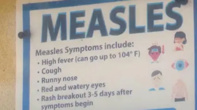 Understanding Measles Symptoms: What You Need to Know