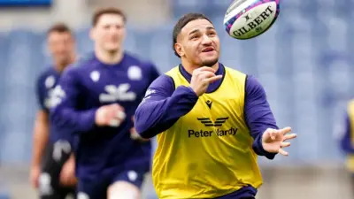 The Historic Rivalry: Scotland vs England