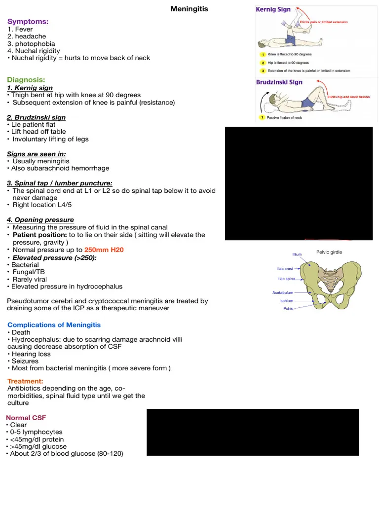 meningitis — GB news