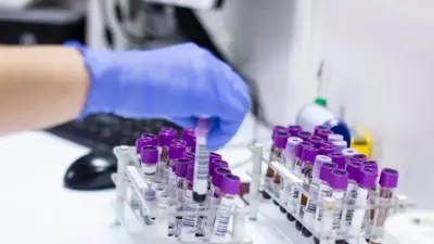 colorectal cancer — GB news